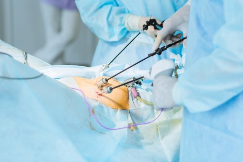 Laparoscopic Surgery in kolathur