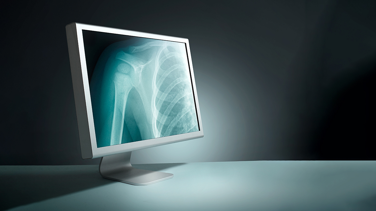 Radiology Treatment in kolathur